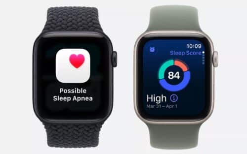 Apple Watch Series 11 : prix, fonctionnalités, date de sortie, on vous dit tout