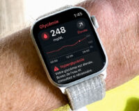 Apple Watch : vers un suivi de la glycémie plus simple pour les diabétiques ?